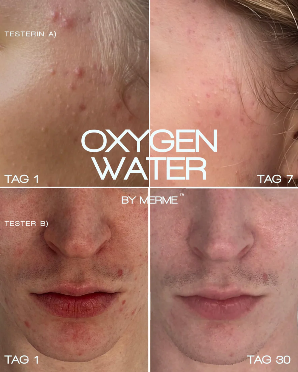 Merme Berlin Oxygen Water Treatment (4 week kit)